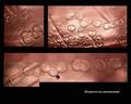 Streptococcus pneumoniae colonies. Colonies characteristic of pneumococci, R form of pneumococcus